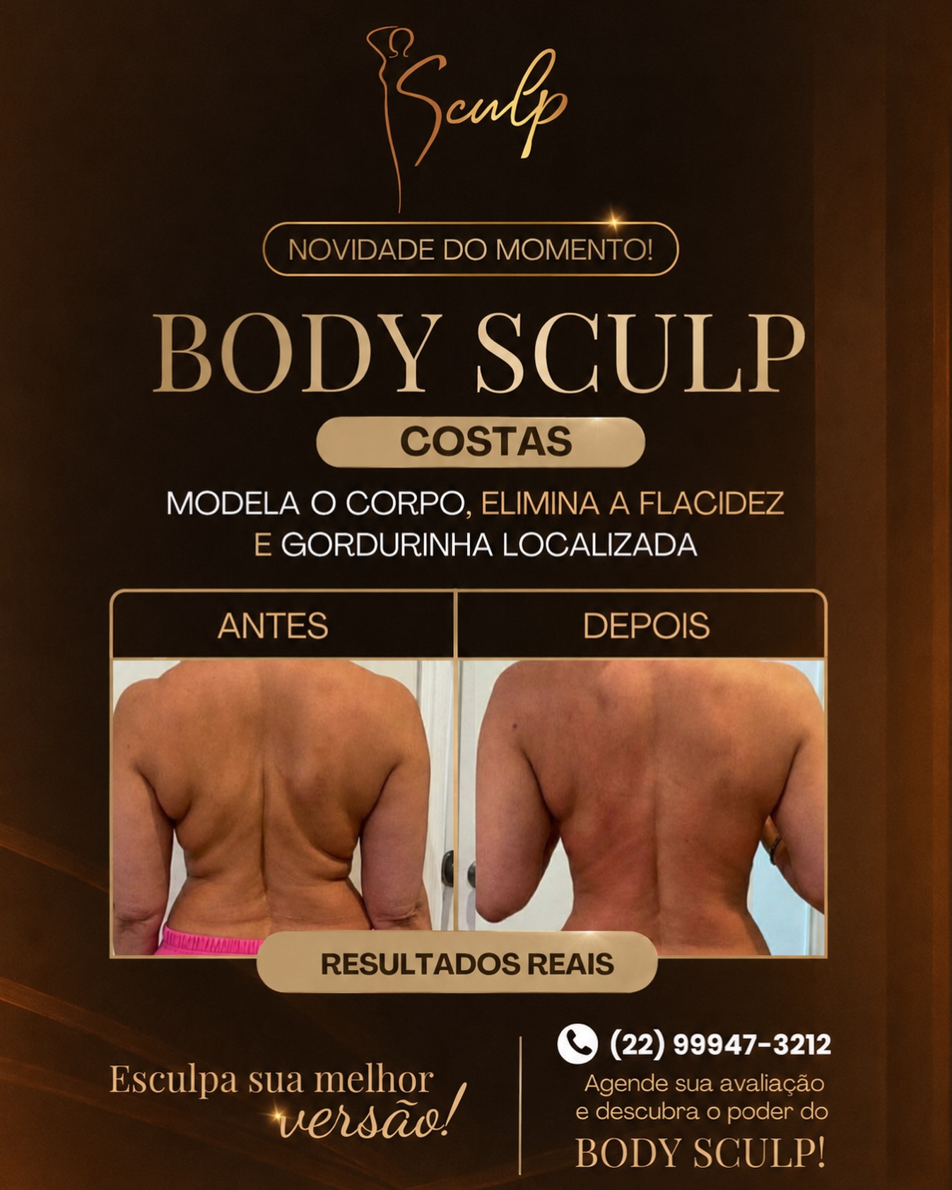 Material informativo Body Sculp da Clínica Sculp
